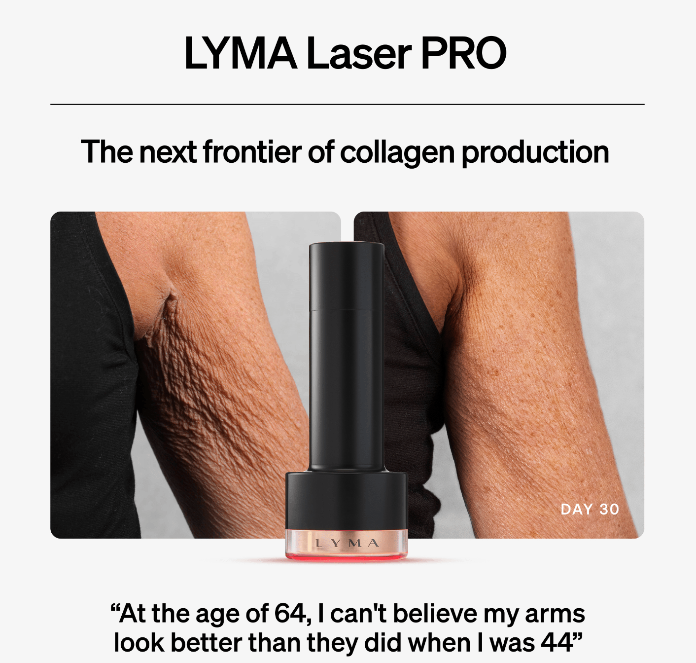 LYMA Laser PRO TOOLS & ACCESSORIES LYMA 